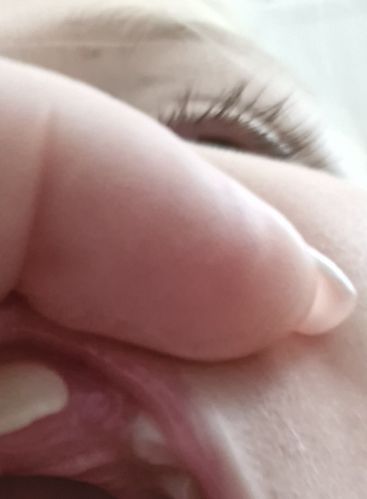 Vyroste ji druhy zub ..(dvojka)?